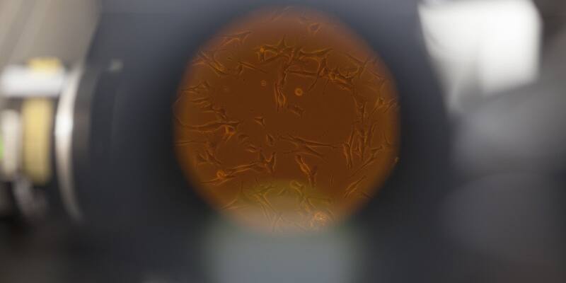 Elongated cells in an orange circle of light seen through a microscope eyepiece, with blurred lab equipment around it